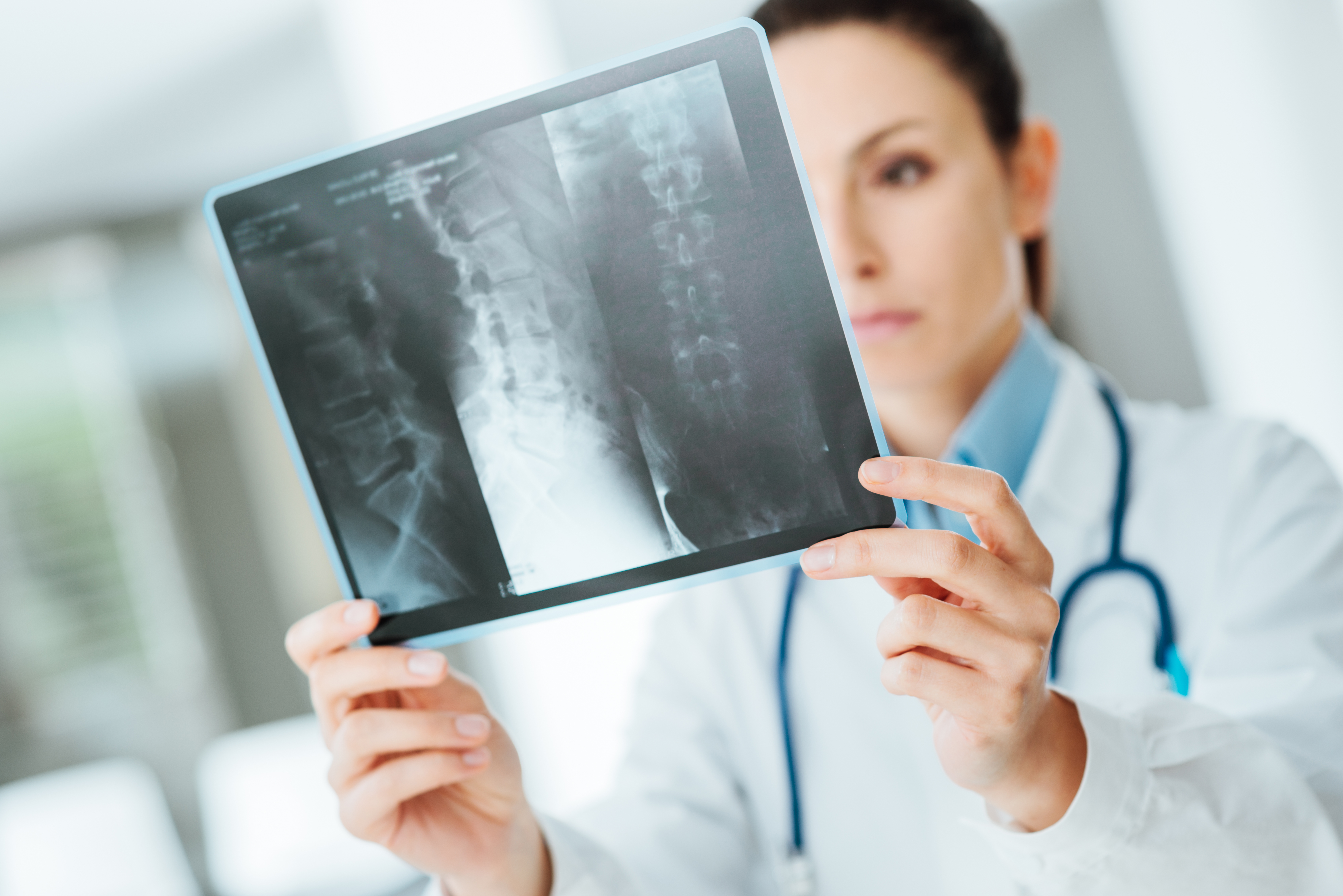 Female doctor examining an x-ray
